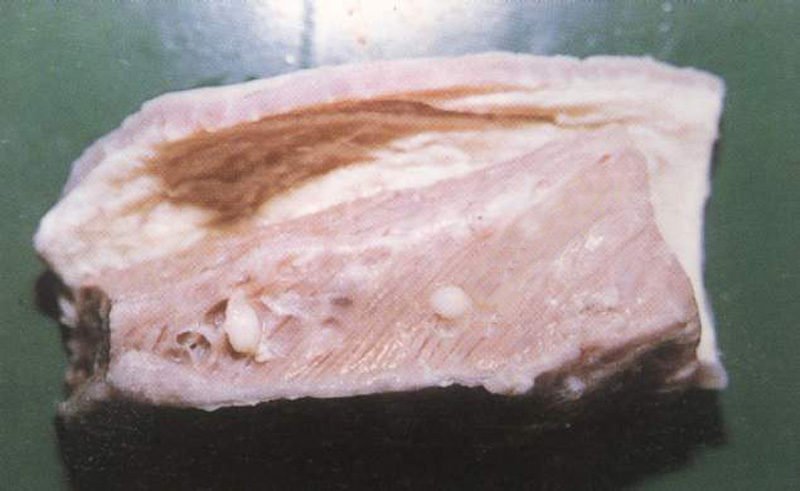 人感染猪囊虫病怎么办,人畜共患寄生虫病中的动物是什么