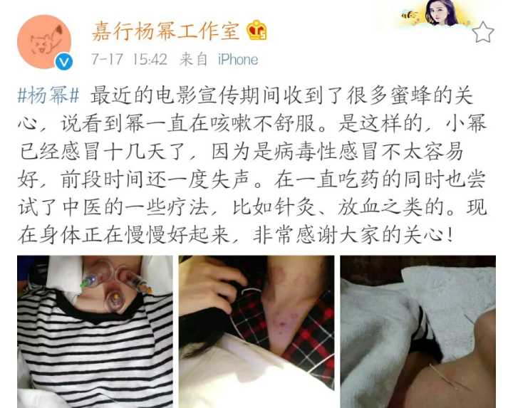 大幂幂干活不要命,生病以至要接受放血治疗,但又被媒体黑是什么梗,网友直逼媒体道歉