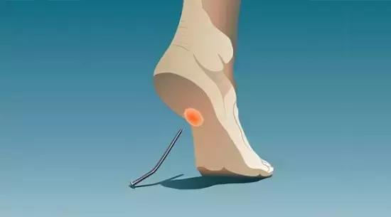 女人脚心抽筋预示三种病,走路脚心胀是什么原因