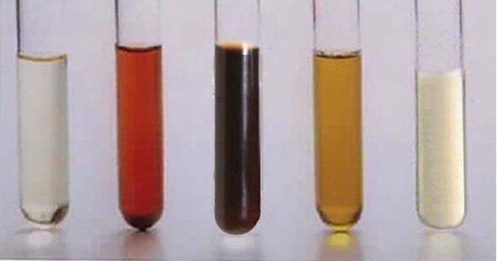 蛋白、潜血患者如何避免10~30年不发展成尿毒症?