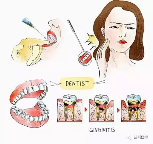 孕妇牙疼怎么办?忍着还是看牙医?