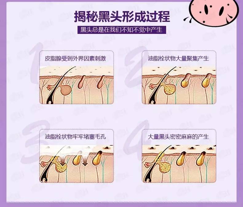 “黑头”这个渣男,彻底和他Say byebye~