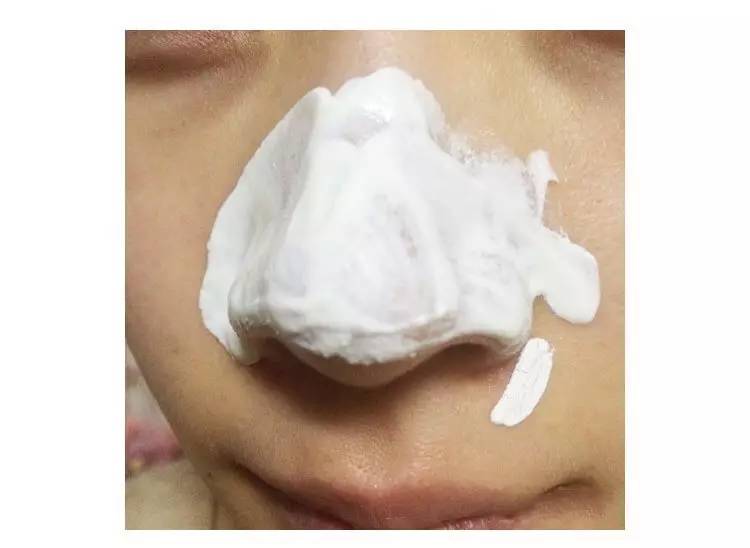 “黑头”这个渣男,彻底和他Say byebye~