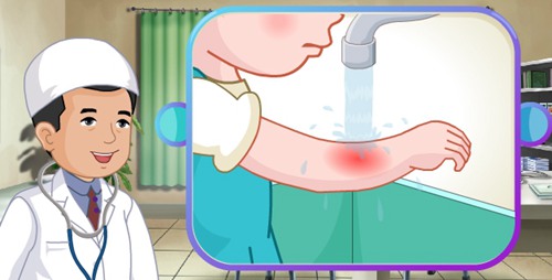 烧烫伤急救的最好方法,孩子夏天防烧烫伤