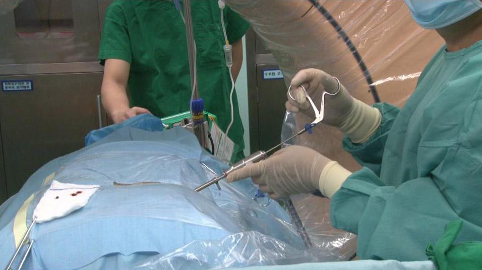 腰椎间盘突出能够压迫胳膊神经吗,腰椎间盘突出能够完全康复吗