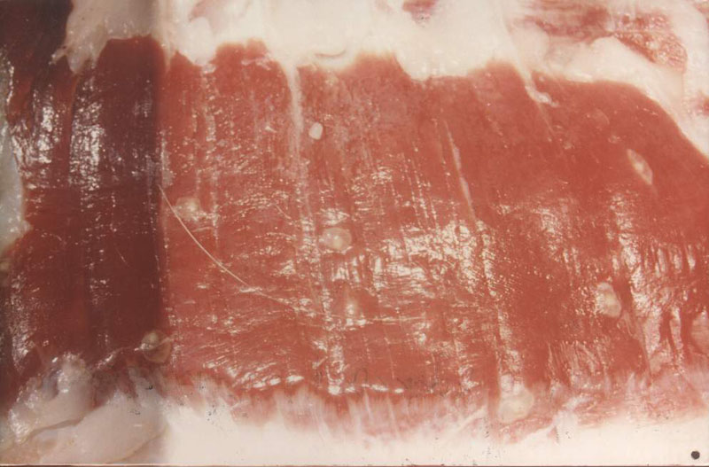 人感染猪囊虫病怎么办,人畜共患寄生虫病中的动物是什么