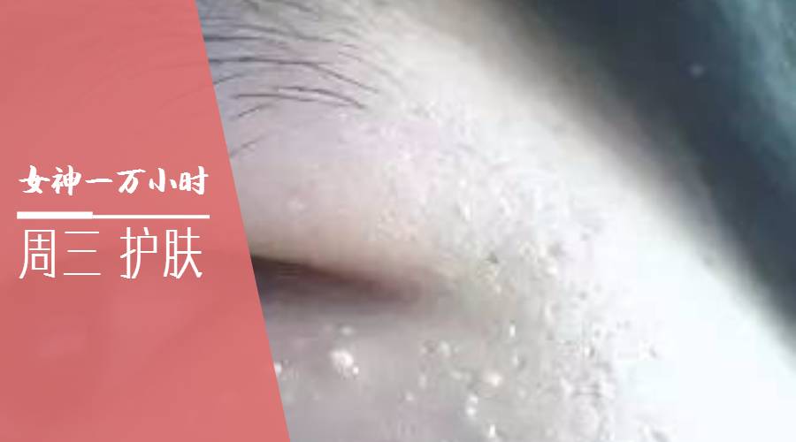 痘痘一直治不好的根本原因,痘痘是痤疮还是毛囊炎怎么判断