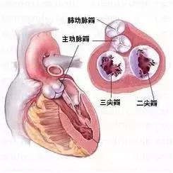 心脏瓣膜置换术费用医保报销多少,心脏瓣膜置换手术一般能活多少年