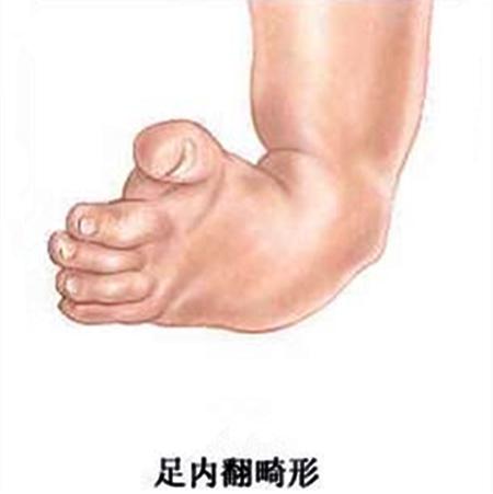 胎儿脊髓栓系术后恢复几率多大,脊髓栓系术后仍然漏尿怎么办