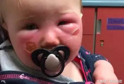 宝宝防晒霜使用不当会造成灼烧?烧烤模式般的天气下,宝宝防晒怎么选,防晒霜怎么用?