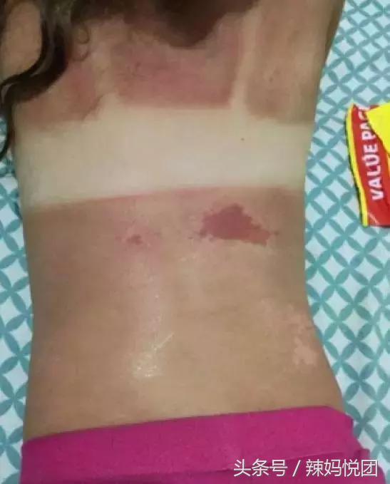 宝宝防晒霜使用不当会造成灼烧?烧烤模式般的天气下,宝宝防晒怎么选,防晒霜怎么用?