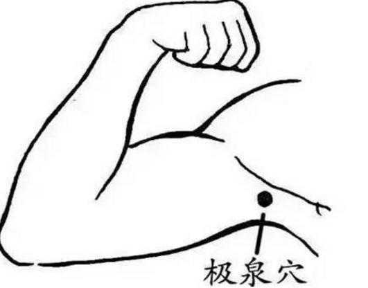 湿气重拔罐多久祛除湿气,湿气重拔罐能解决湿气吗