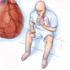 熟睡中因憋气而惊醒、呼吸困难,这些都是心力衰竭的症状,它发病率高,病残、病逝几率也高