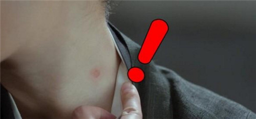 杨幂脖子前后对比,杨幂吻痕