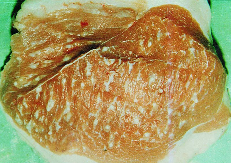 人感染猪囊虫病怎么办,人畜共患寄生虫病中的动物是什么