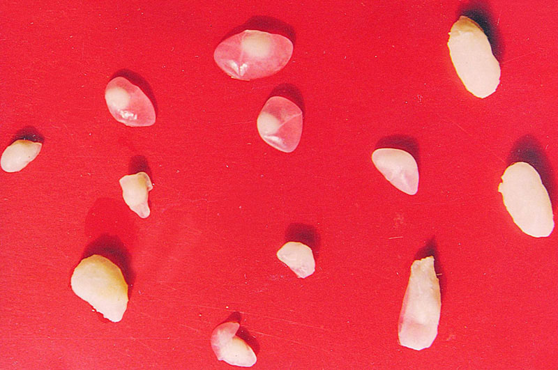 人感染猪囊虫病怎么办,人畜共患寄生虫病中的动物是什么