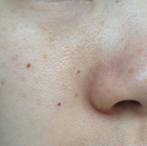 桃桃养生护肤,桃桃美容护肤