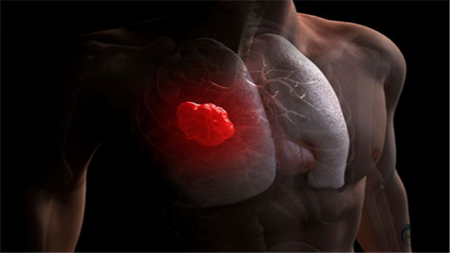 鸦胆子油与消癌平,鸦胆子油抗癌的效果