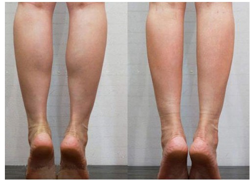 6个下身肥胖的原因及对策！不看就继续肥下去吧