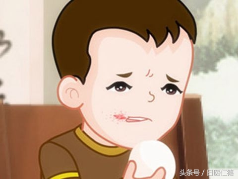 宝宝口角炎症状，怎样预防？