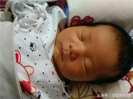 黄疸值超过这个数字会伤害大脑!关于黄疸,父母不可不知这4点