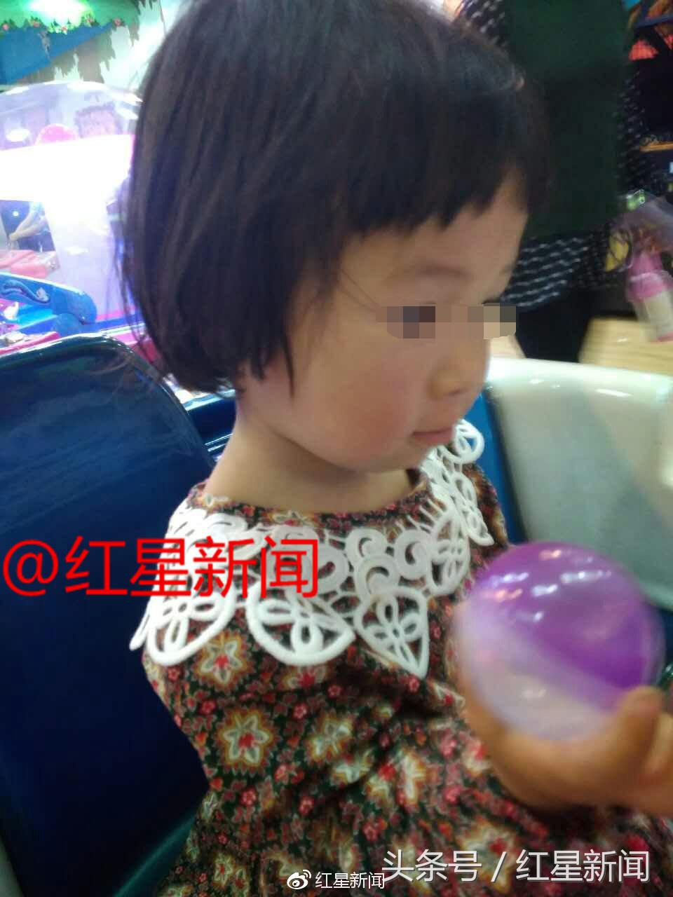 1岁女童被2000度开水烫伤后续,2岁女儿被开水烫伤完整版