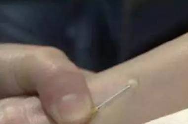 护士打针哪种握针方法更好,儿科护士打针技巧