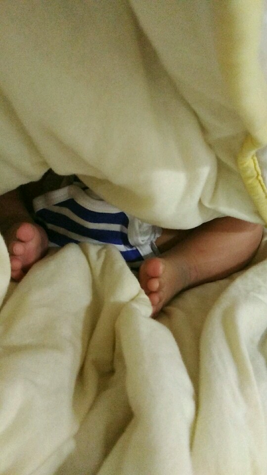 马蹄足内翻宝宝康复记,给相同经历的宝妈一些正能量