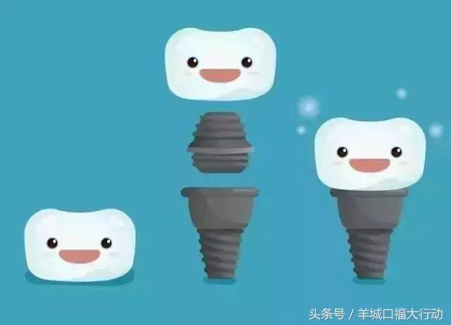 小孩牙齿先天性缺失怎么办,牙齿缺失了到底怎么办