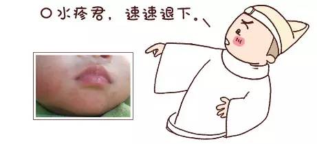 湿疹跟热疹的区别尿布疹,新生儿湿疹或热疹尿布疹怎么判断