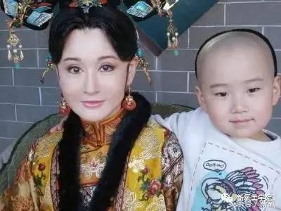 小s脸肿原因,小s脸怎么越来越肿