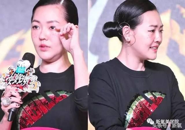 小s脸肿原因,小s脸怎么越来越肿