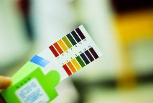 怎么看懂尿常规化验单,一文教你看懂肝功能报告单