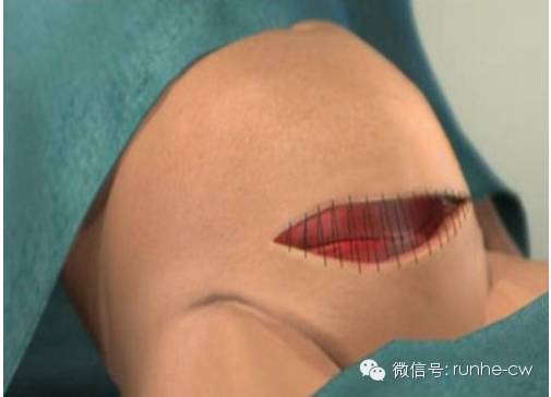 产妇产后会有哪些症状,新手妈妈必须警惕的病