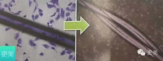 脸部缝美容线好还是普通线好,医院埋线和美容院埋线有什么差别