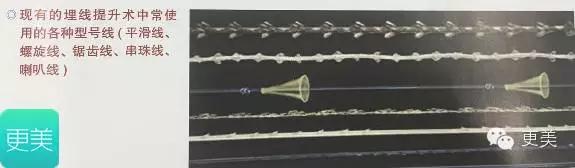 脸部缝美容线好还是普通线好,医院埋线和美容院埋线有什么差别