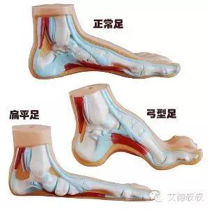 怎么有效教孩子区分左右鞋,对于穿错鞋子的孩子教育措施