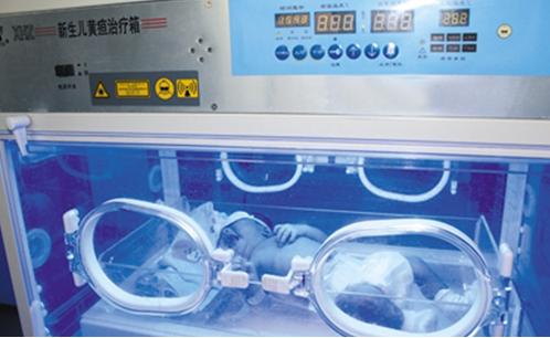 宝宝黄疸高怎么可以让黄疸退下来,黄疸有什么危险