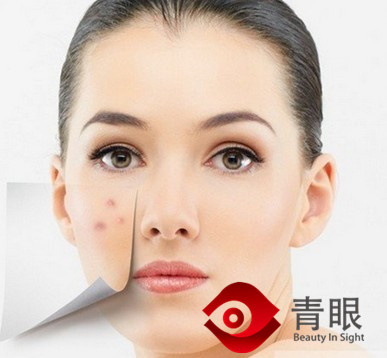 只不过因为在敏感季用了年前的化妆品,她再也不想去踏春了!