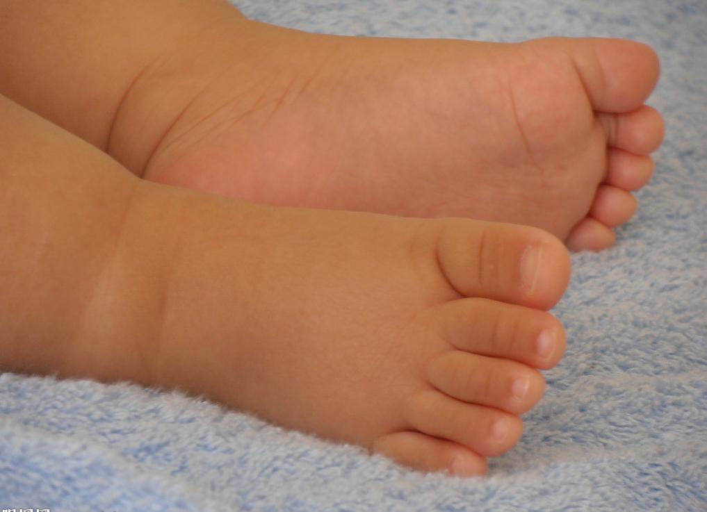 真菌感染脚气长水泡严重后果,脚气引起真菌感染会有什么后果