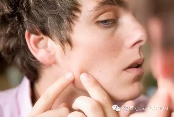 淡化痘印痘坑的5个小妙招,痘坑怎么治疗不会色素沉淀