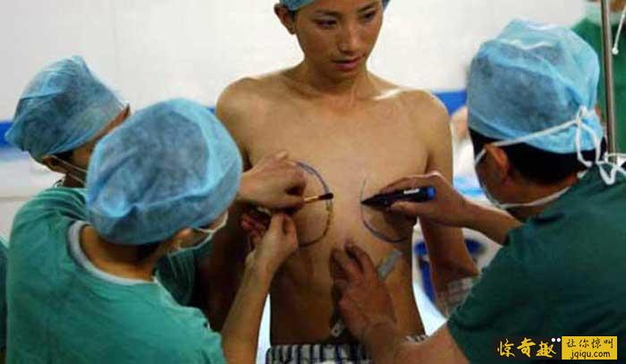 泰国人妖变性手术后寿命长吗,泰国人妖变性手术后寿命