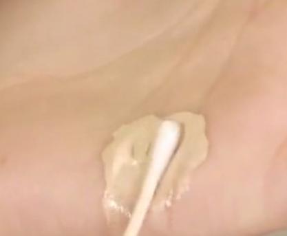 澶槼鐨勫悗瑁斿畫鎱т箶鐪肩嚎鐢绘硶,瀹嬫収涔斿お闃崇殑鍚庤鐪煎