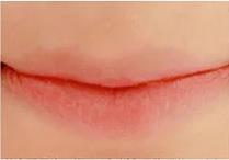 澶槼鐨勫悗瑁斿畫鎱т箶鐪肩嚎鐢绘硶,瀹嬫収涔斿お闃崇殑鍚庤鐪煎