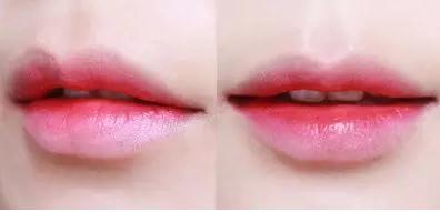 澶槼鐨勫悗瑁斿畫鎱т箶鐪肩嚎鐢绘硶,瀹嬫収涔斿お闃崇殑鍚庤鐪煎