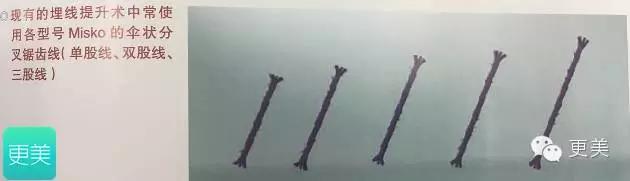 脸部缝美容线好还是普通线好,医院埋线和美容院埋线有什么差别