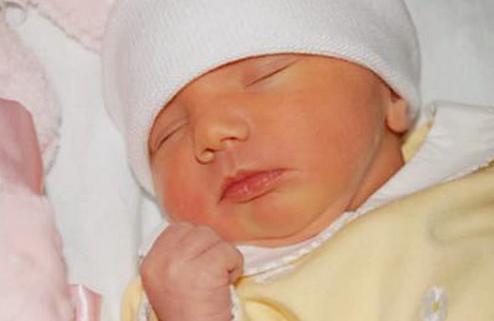 宝宝黄疸高怎么可以让黄疸退下来,黄疸有什么危险