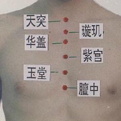 咳嗽老不好,赶快来瞅一瞅