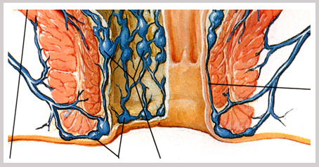 她肛门涨的难受,非常不舒服,以为有啥不好的事情呢