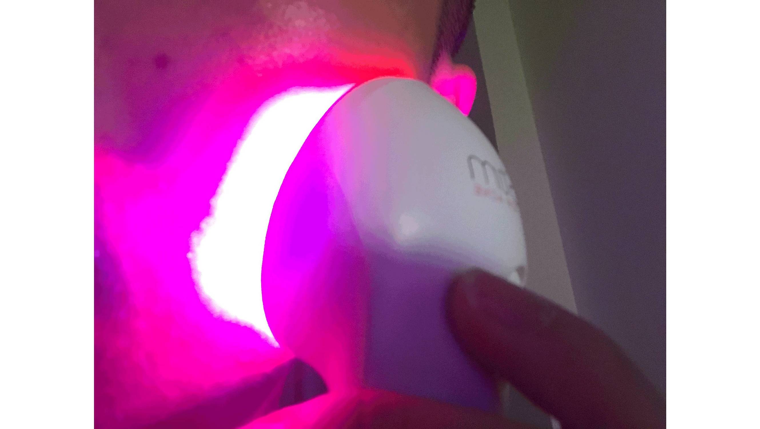 我的祛斑血泪史完整版,我的祛痘史